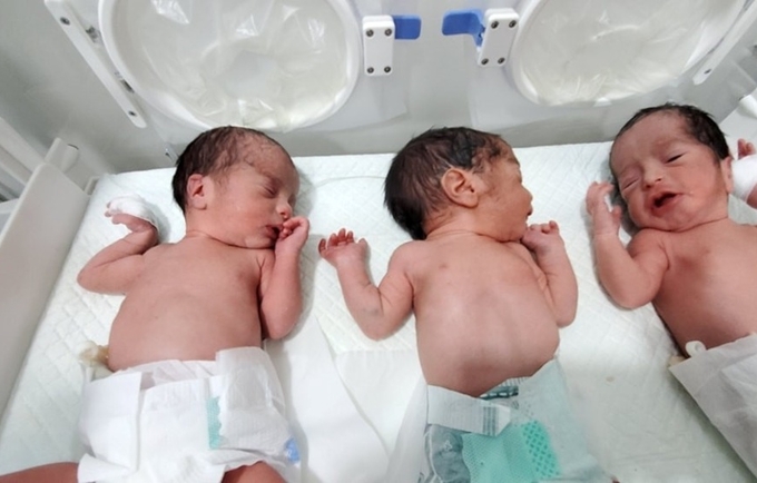 Triplets delivered via C-section at Marib General Hospital 