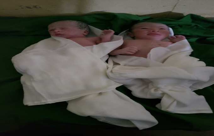 Halimah’s twins a few minutes after their birth ©BFD/UNFPA Yemen 