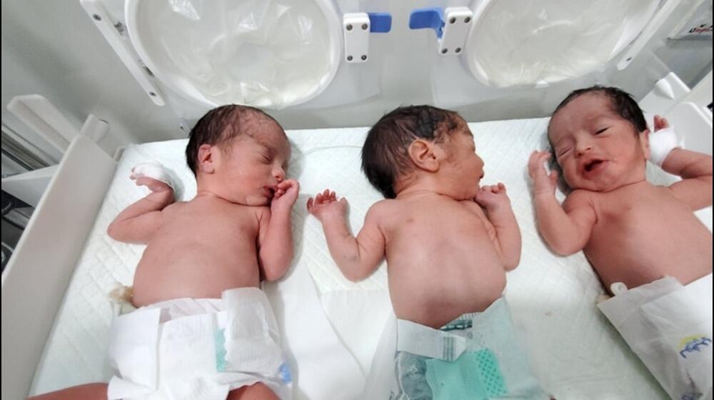 Triplets delivered via C-section at Marib General Hospital 